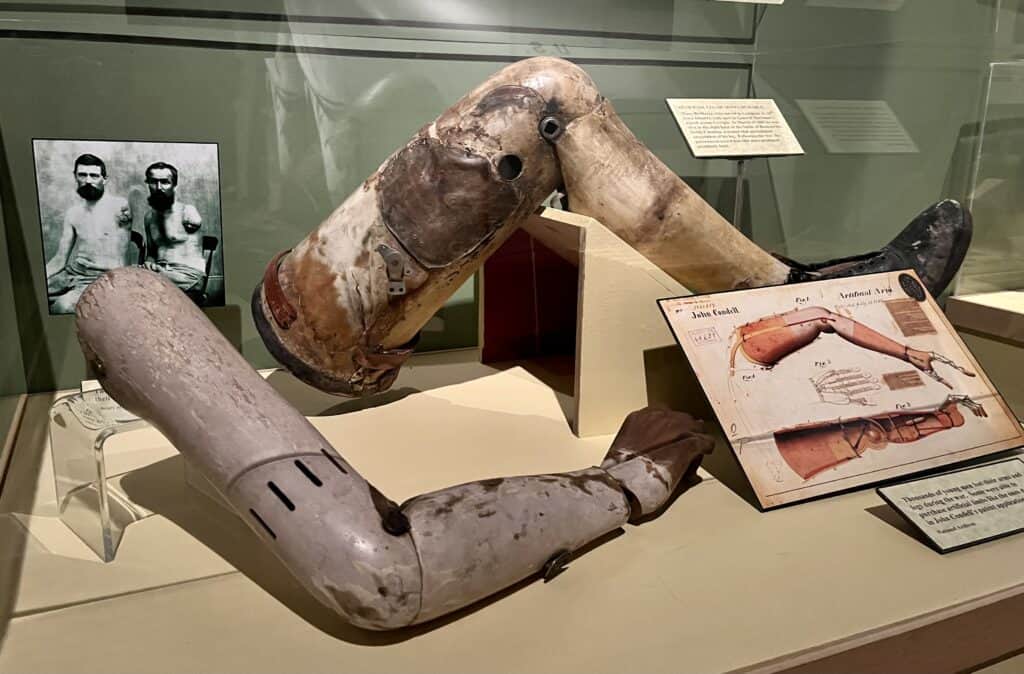Civil War prosthetics